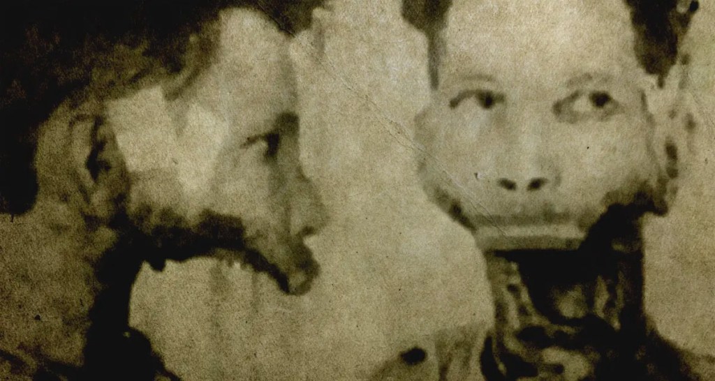 An image showing Eben Byers without his jaw after it was surgically removed due to repeated exposure to radiation.