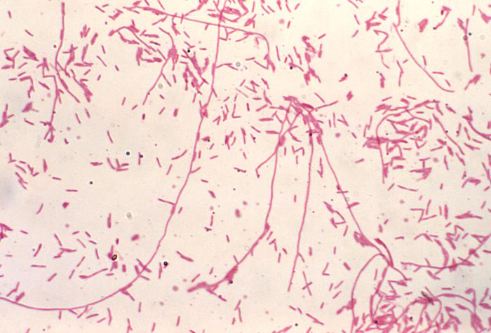 A gram staining showing bacilli of L. pneumophilia bacteria as gram negative. Some bacteria are spead out among the sample, where others form bunches and chains.